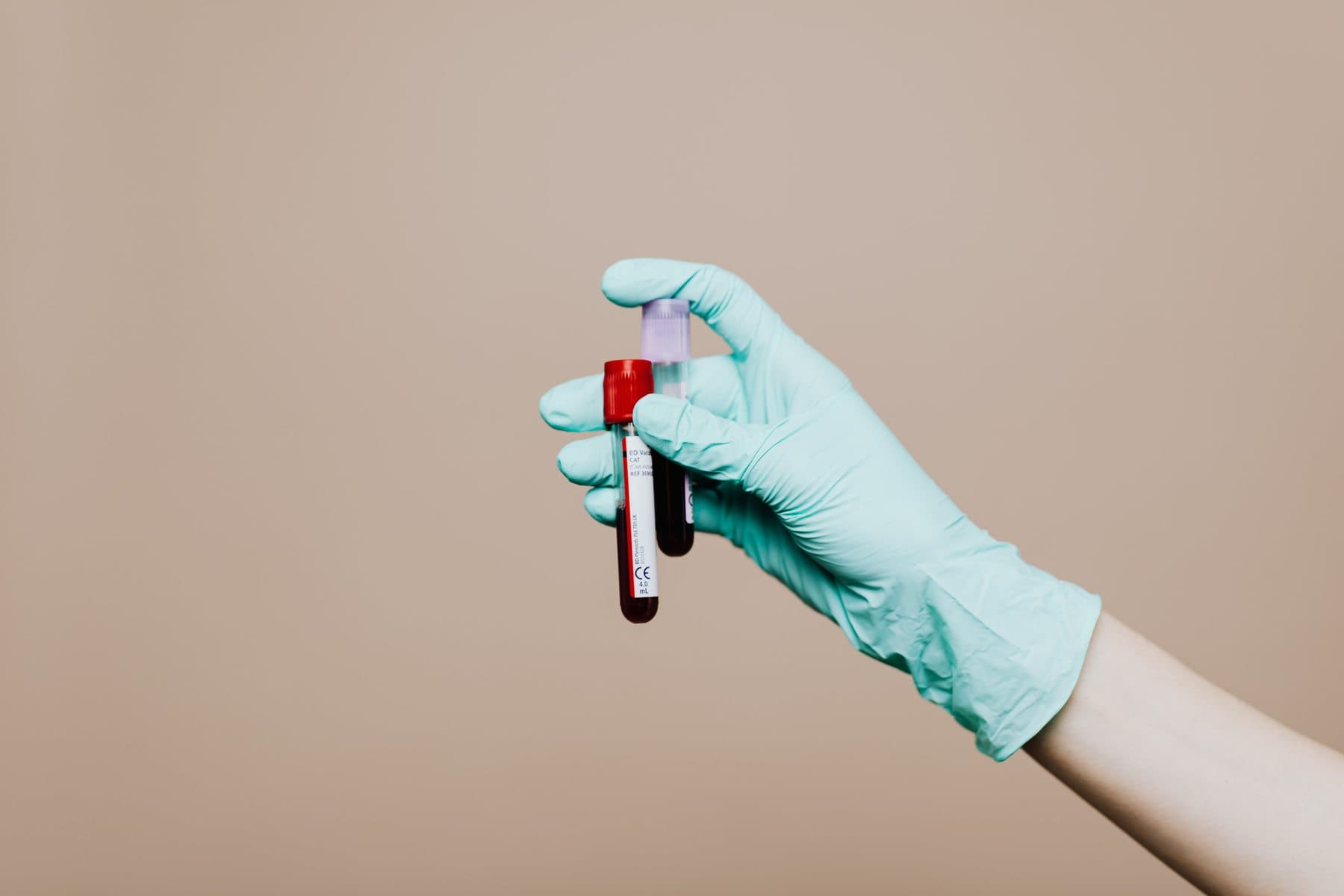 Tubos de coleta de sangue para exame laboratorial de PSA