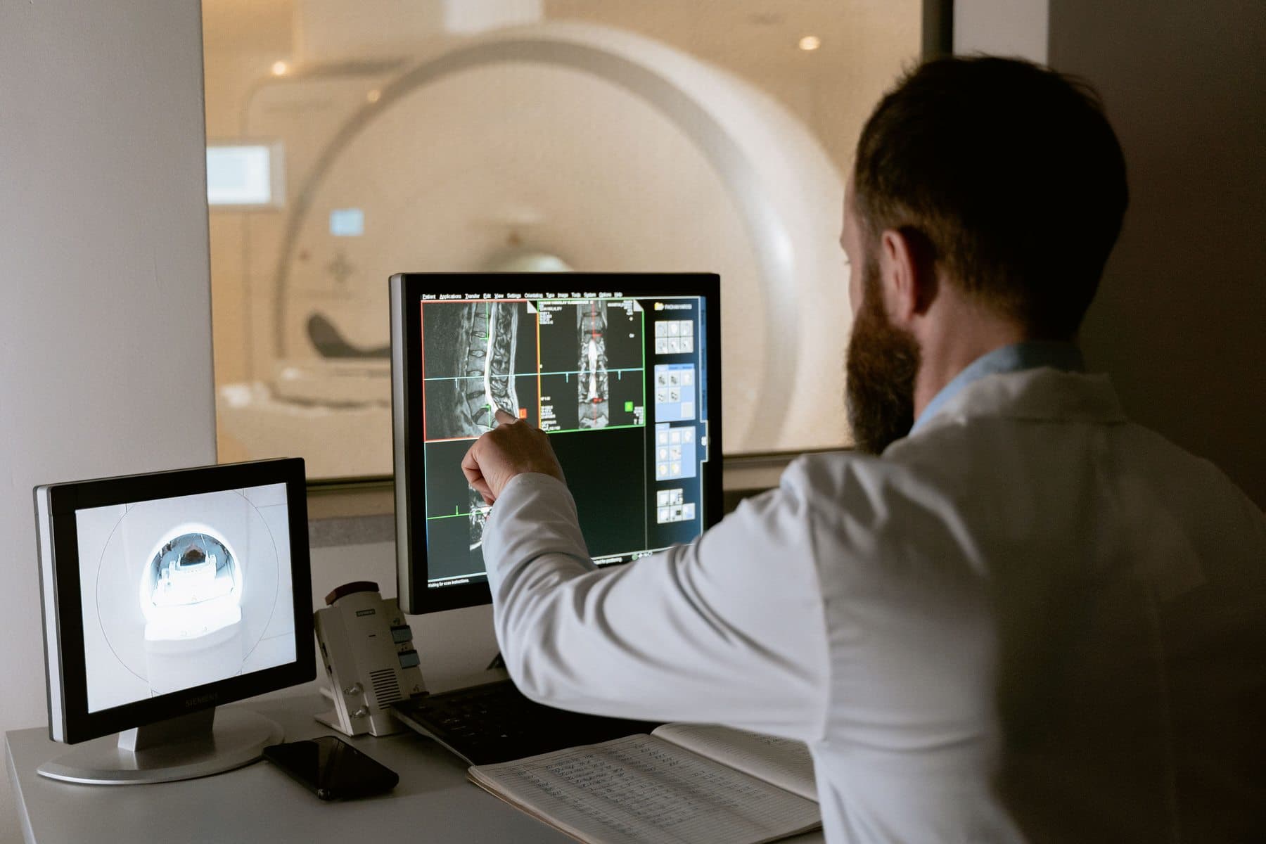 Médico analisando imagens de ressonância magnética que orientam a biópsia