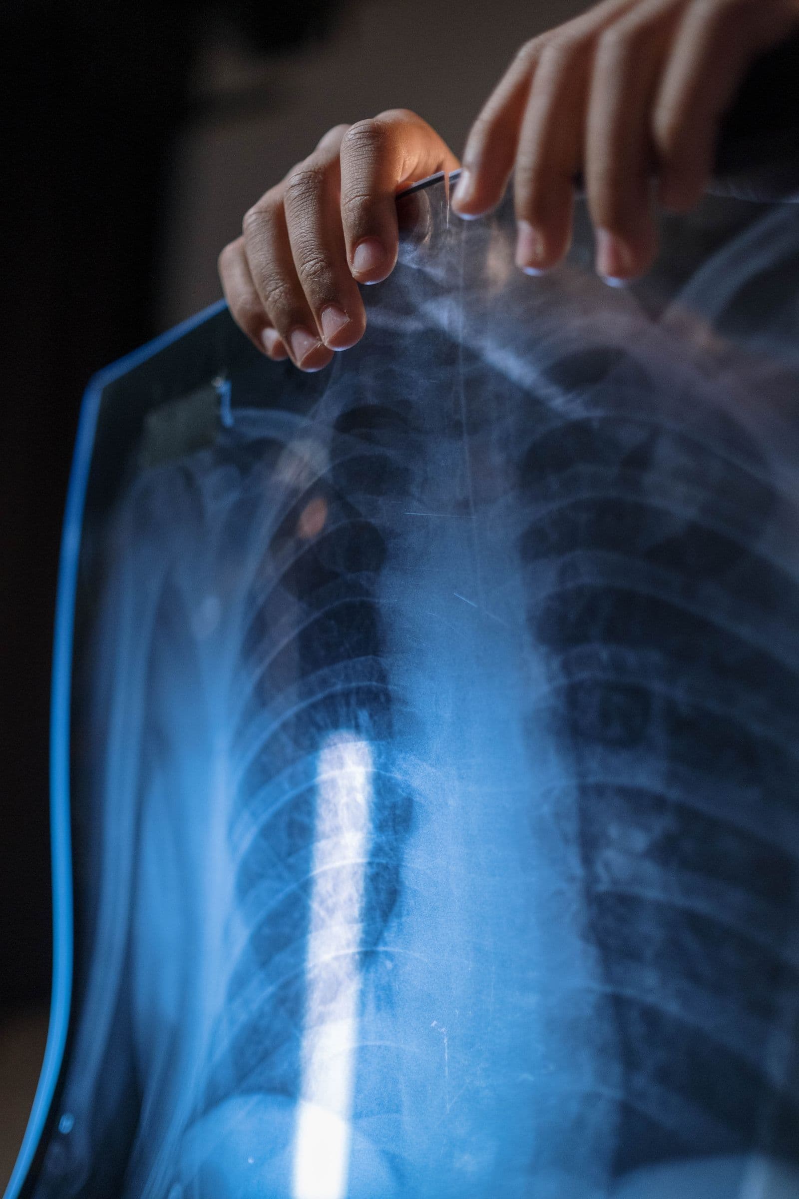 Profissional examinando radiografia de tórax contra a luz