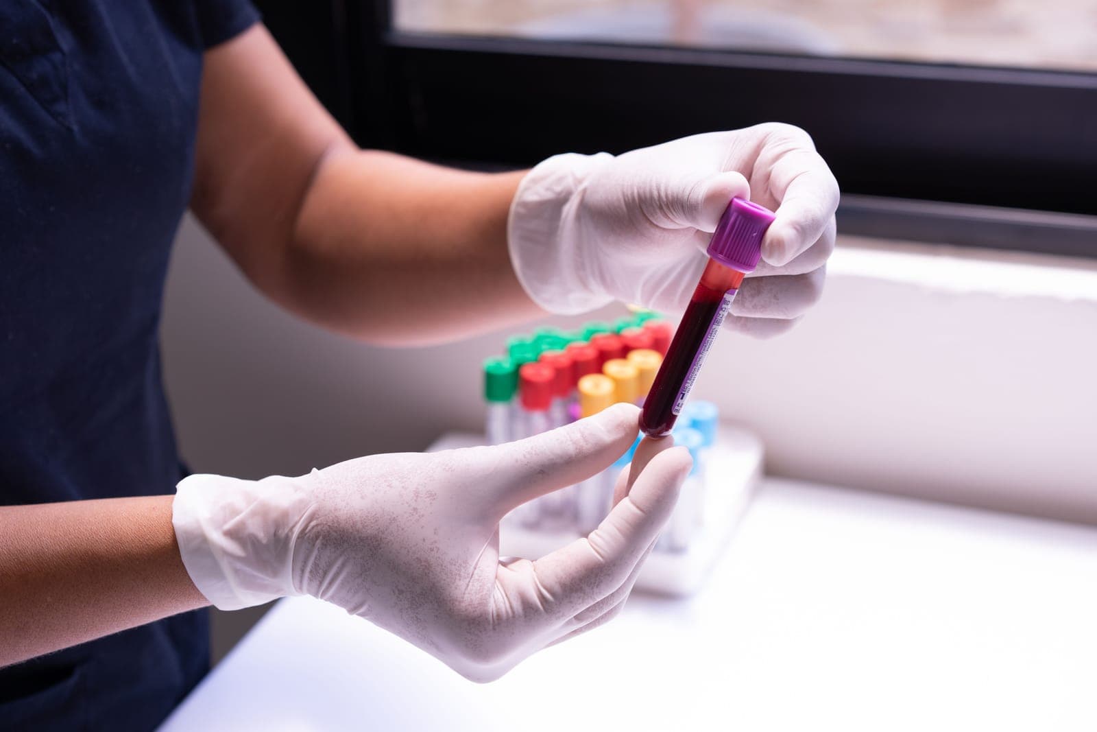 Mãos com luvas manipulando tubos de sangue no laboratório